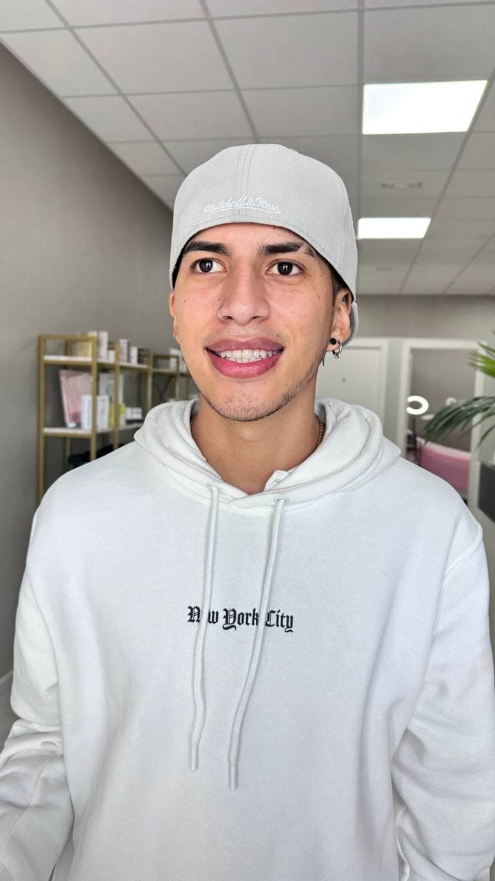 Botulinoterapia