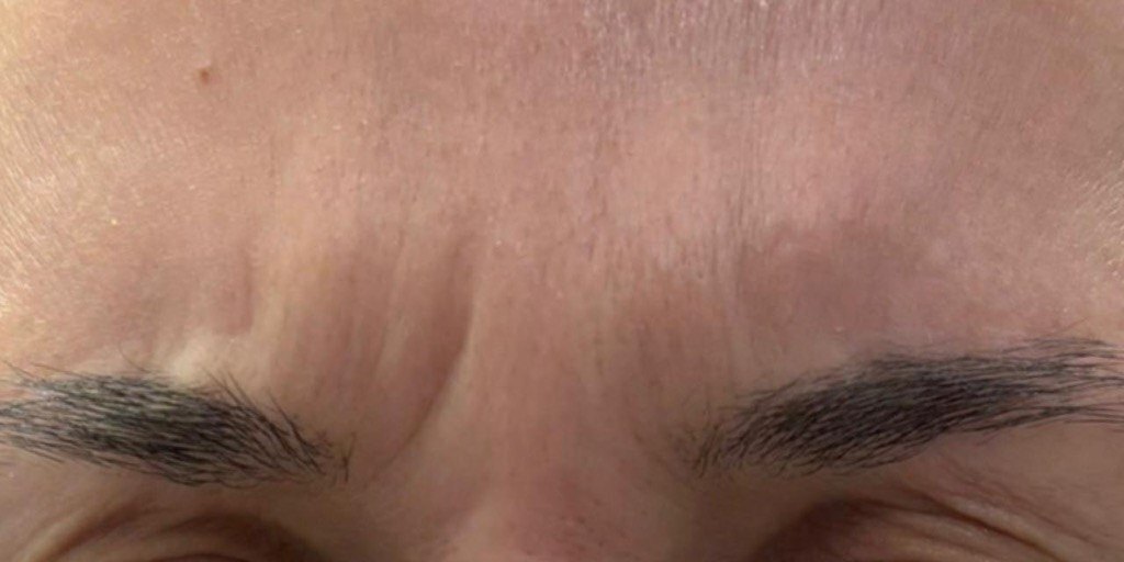 Antes